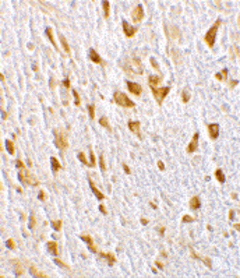 AGAP2 Antibody - BSA Free
