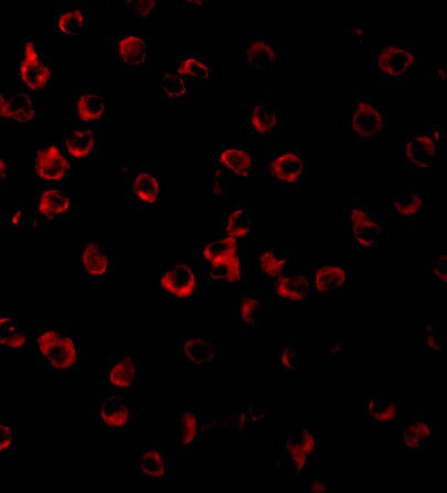 TLR11 Antibody - BSA Free
