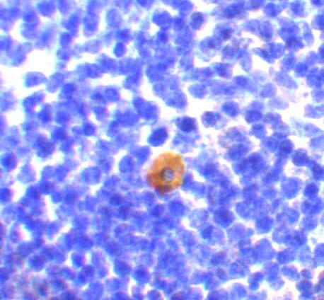 CARD11/CARMA1 Antibody - BSA Free