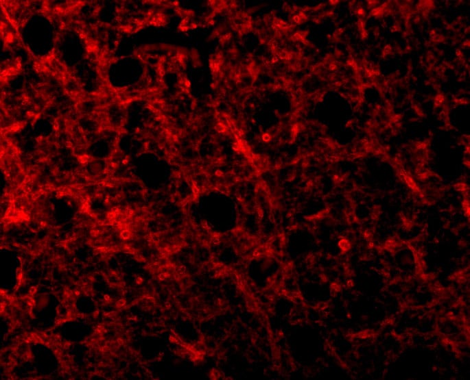 TEM8/ANTXR1 Antibody - BSA Free