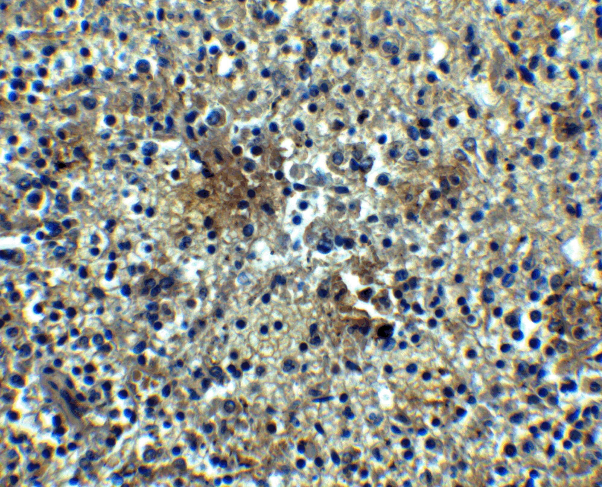 BAFFR/TNFRSF13C Antibody - BSA Free