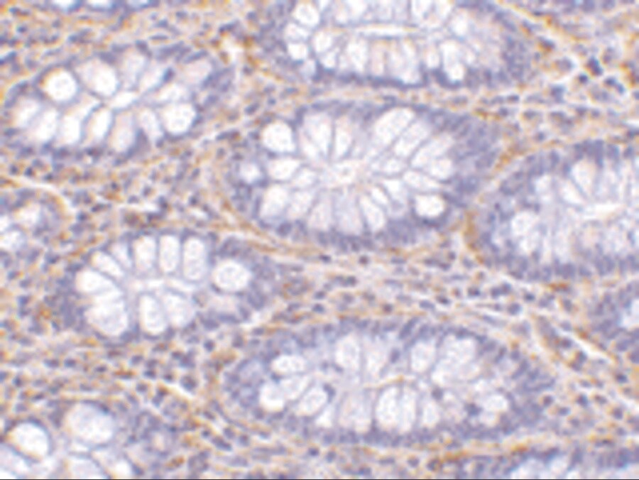 PAK4 Antibody - BSA Free