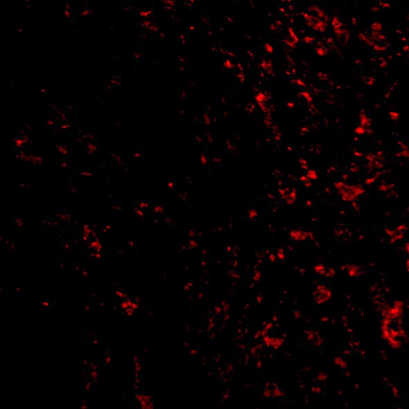 PAK4 Antibody - BSA Free