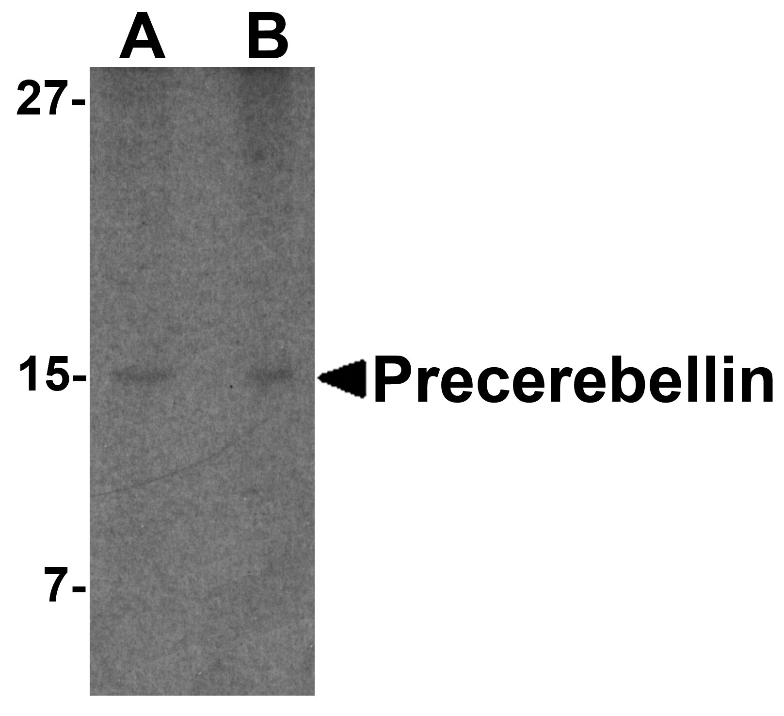 Cerebellin-1/Precerebellin Antibody - BSA Free