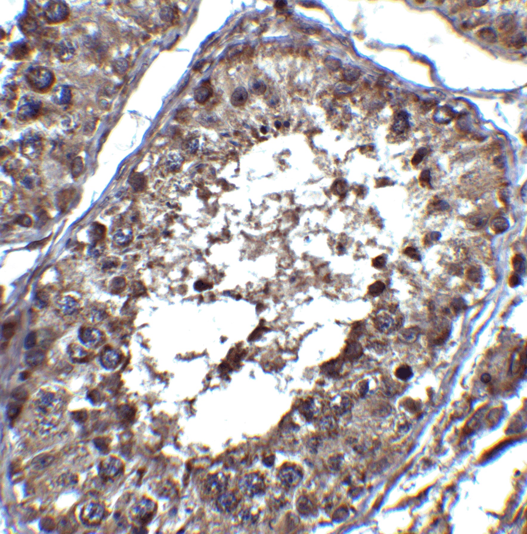 PIST Antibody - BSA Free
