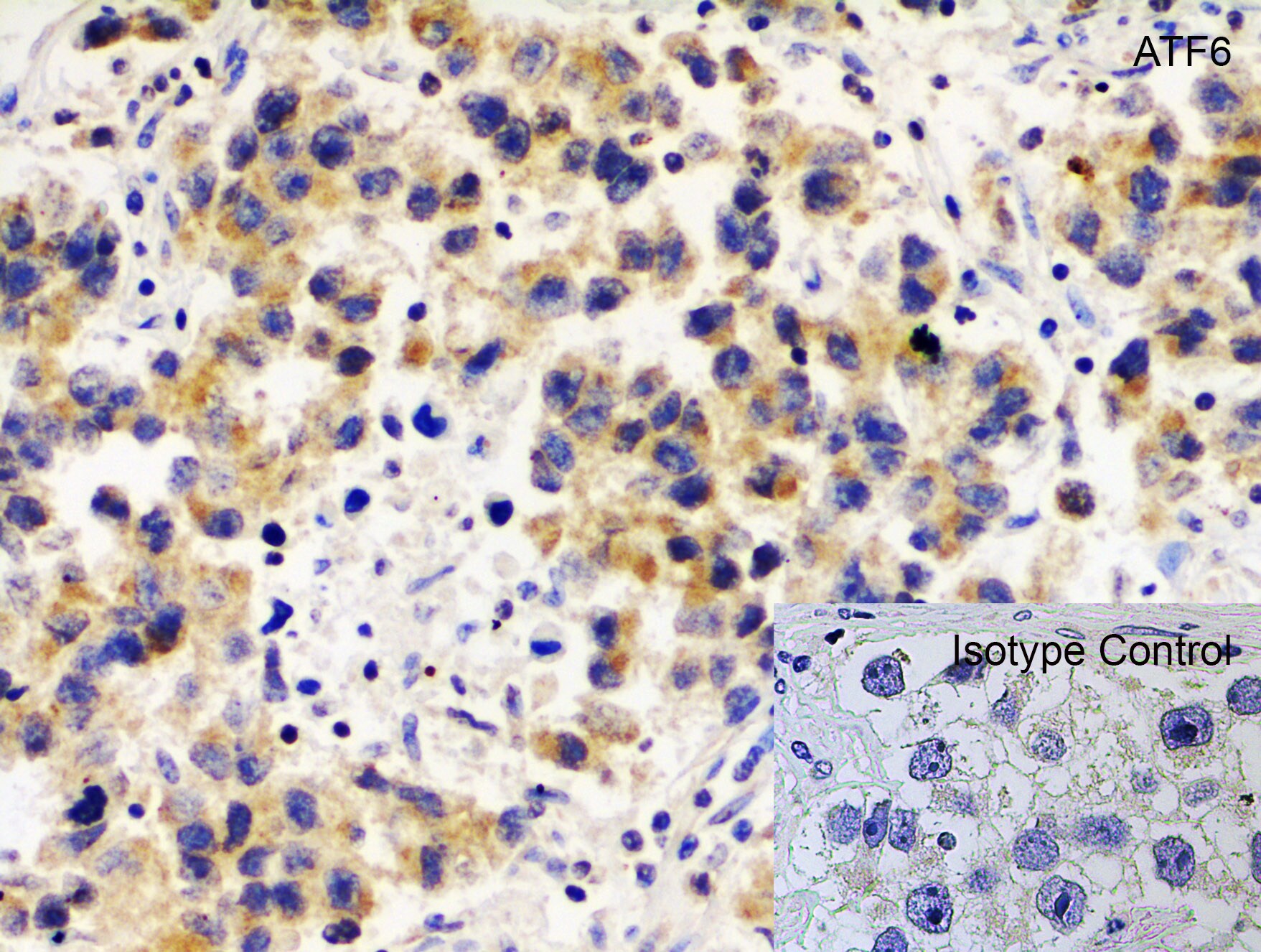 ATF6 Antibody - BSA Free