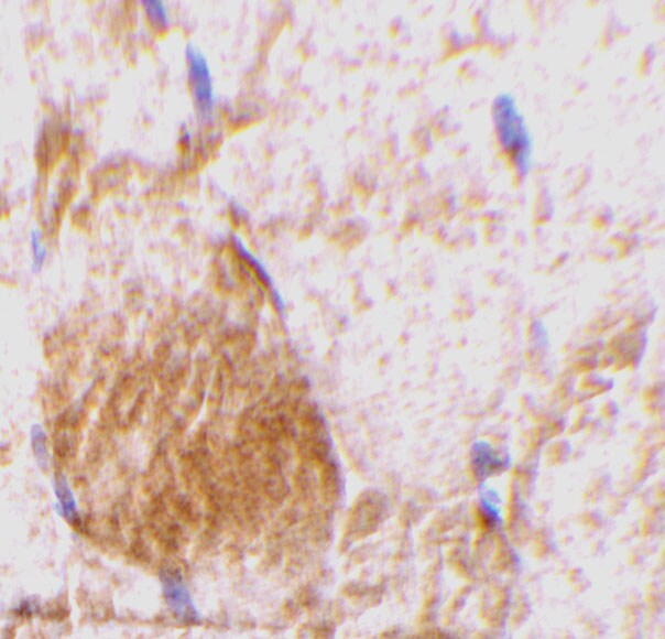 IL-31 Antibody - BSA Free