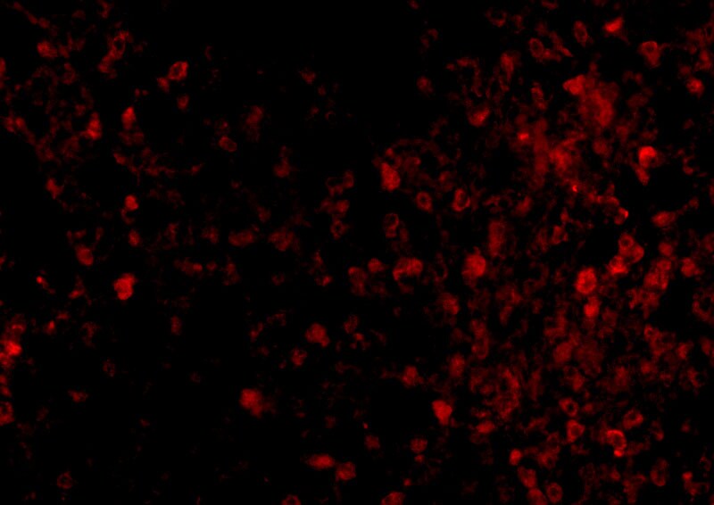 TRPC6 Antibody - BSA Free