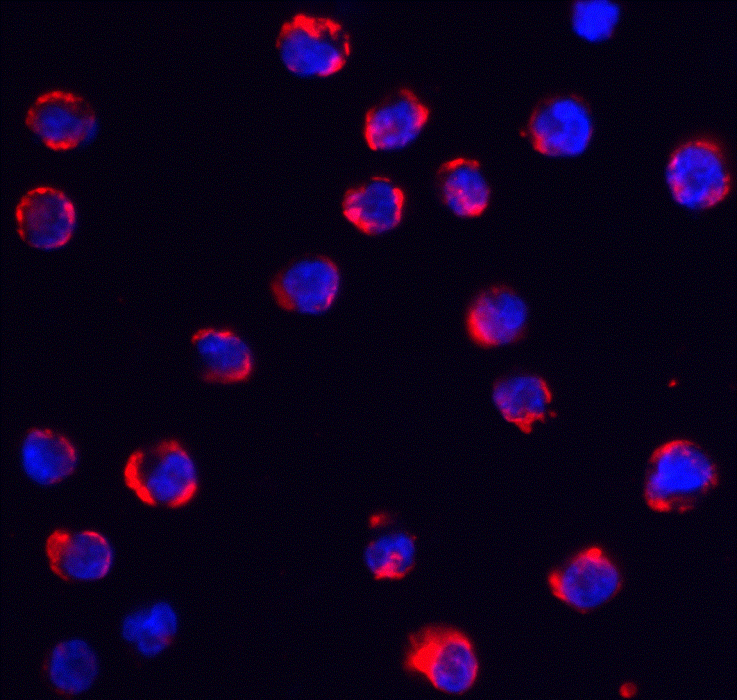 TRPC6 Antibody - BSA Free