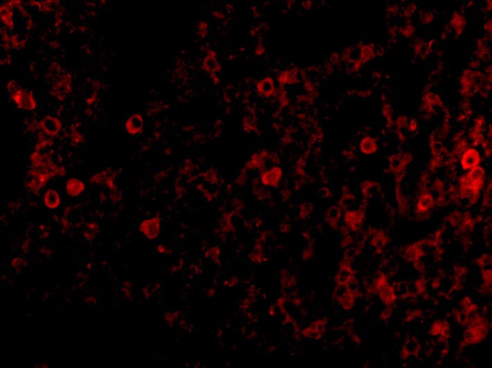 PKR Antibody - BSA Free