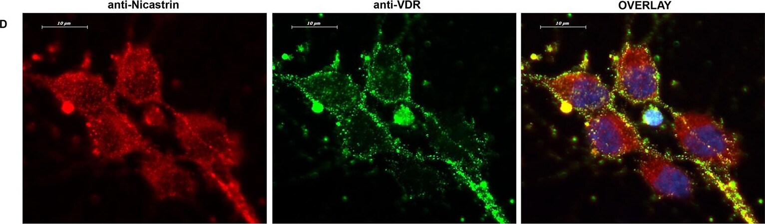 Nicastrin Antibody - BSA Free