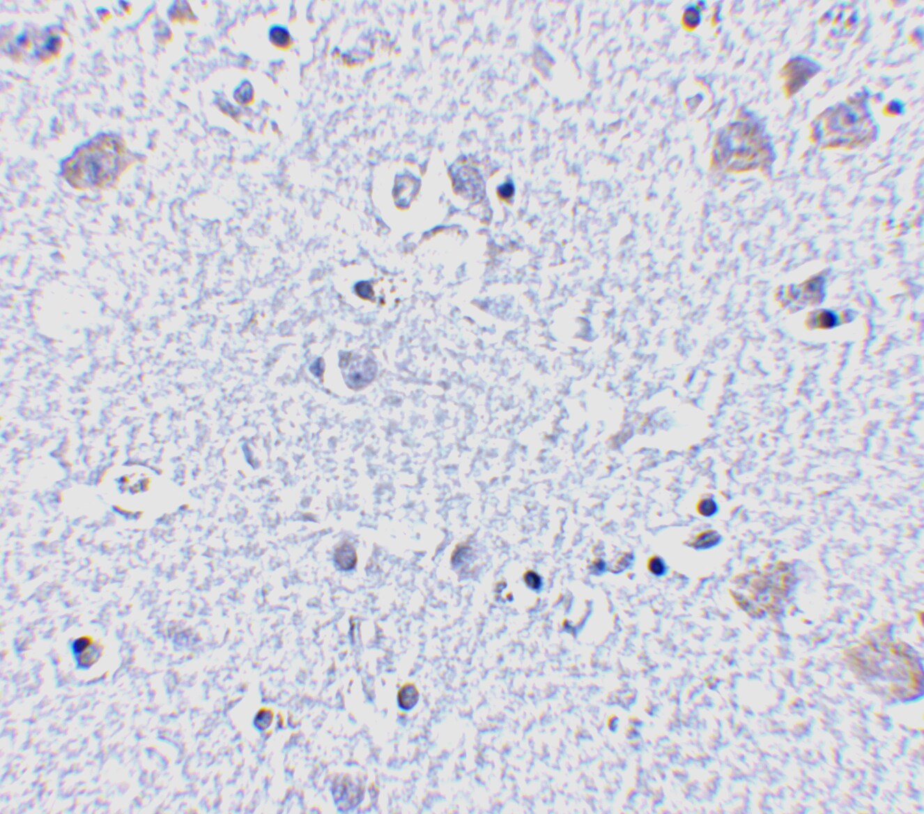 BRSK1 Antibody - BSA Free