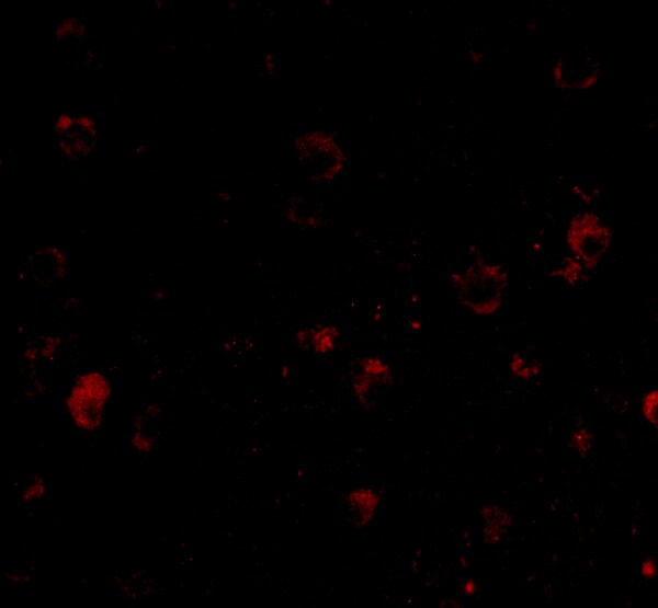 BRSK1 Antibody - BSA Free