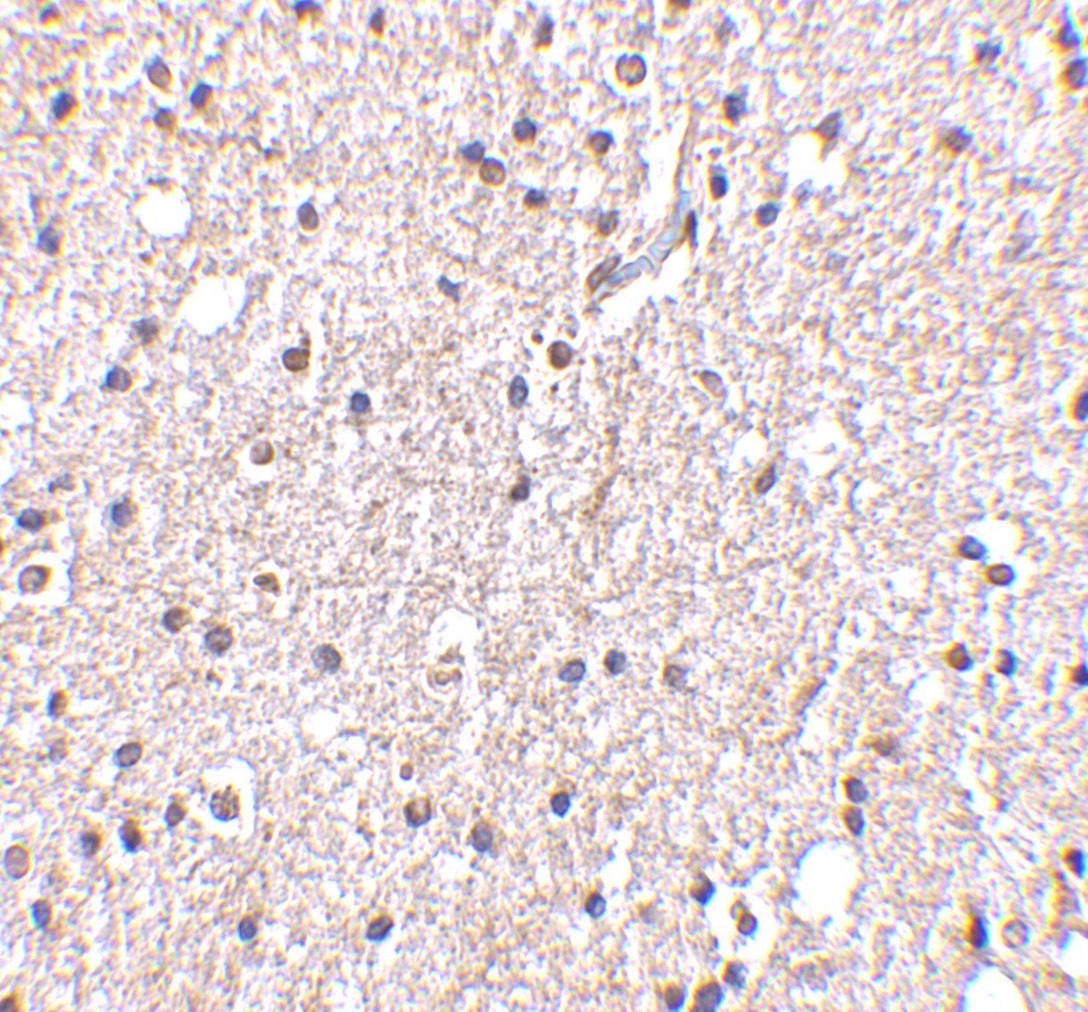 BRSK2 Antibody - BSA Free