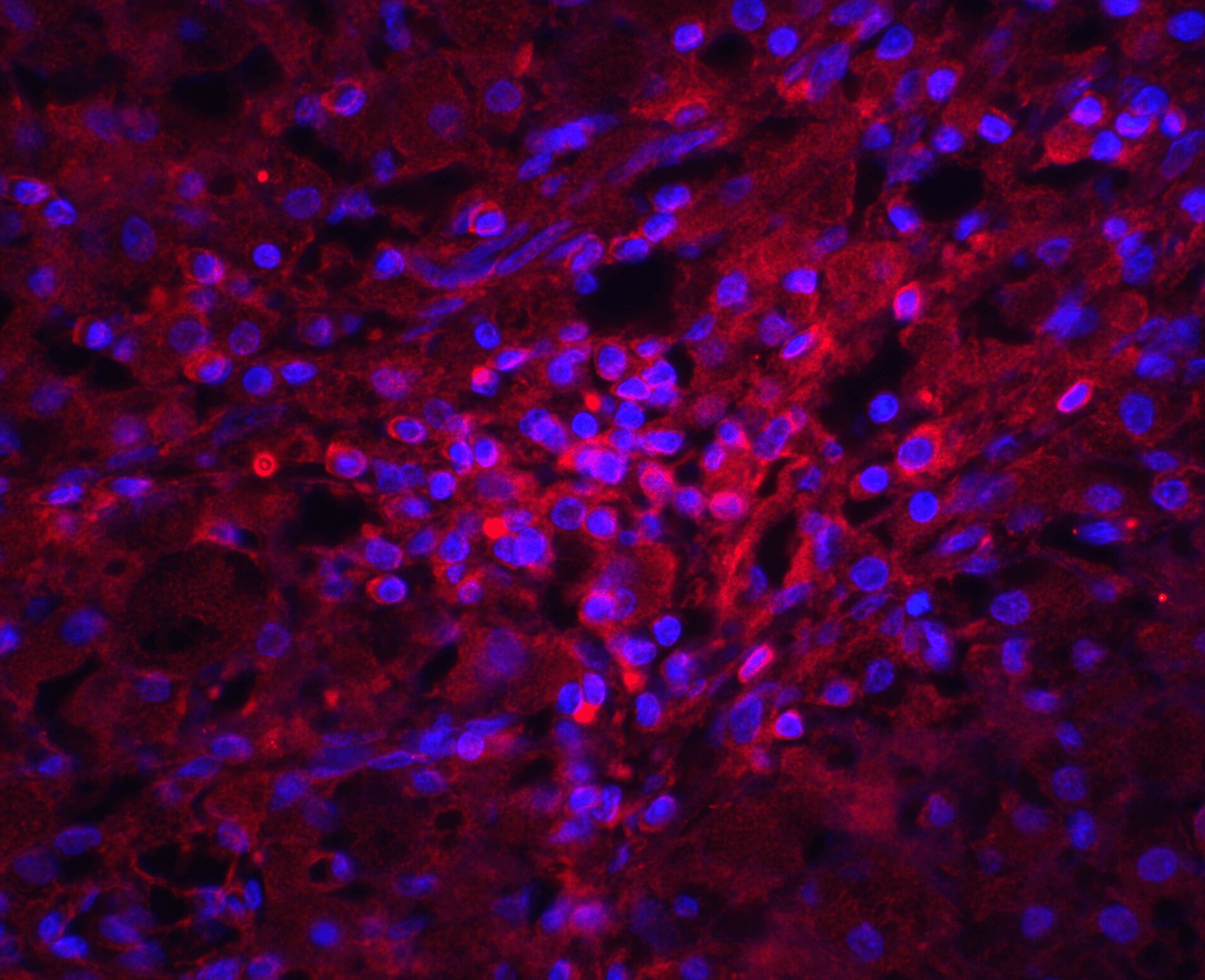 Orai1 Antibody - BSA Free