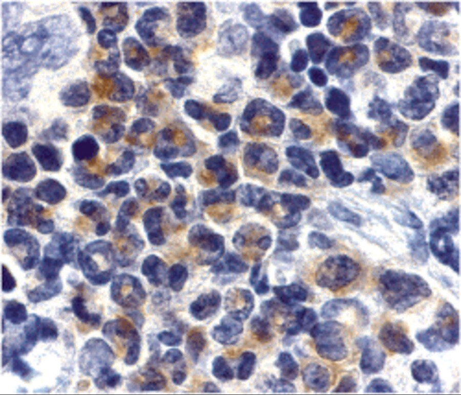 DAP Kinase 2 Antibody - BSA Free