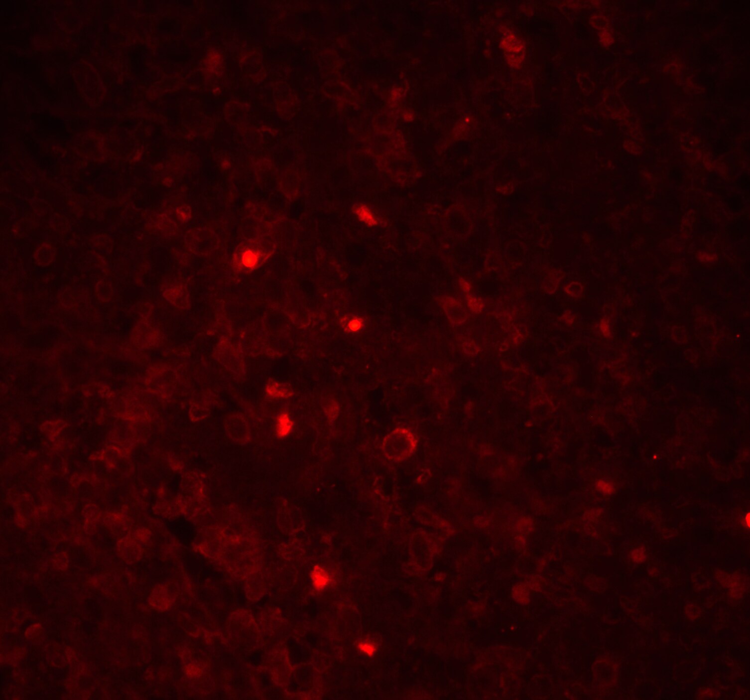 ASC/TMS1 Antibody - BSA Free