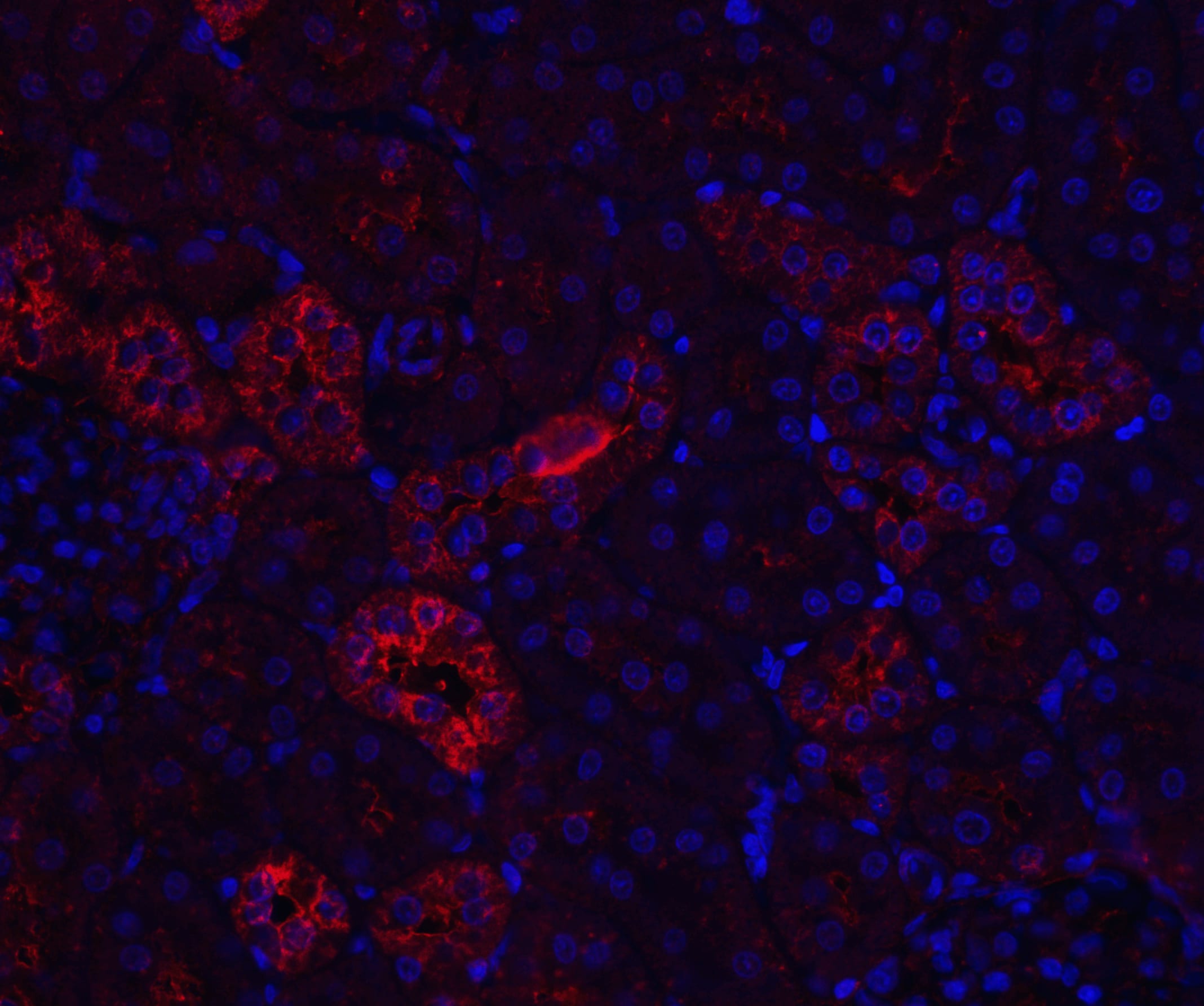 Nephrin Antibody - BSA Free