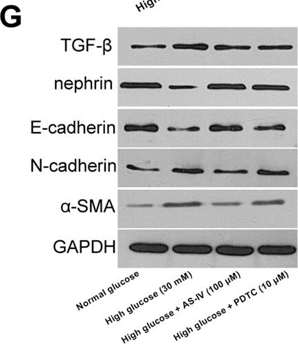Nephrin Antibody - BSA Free