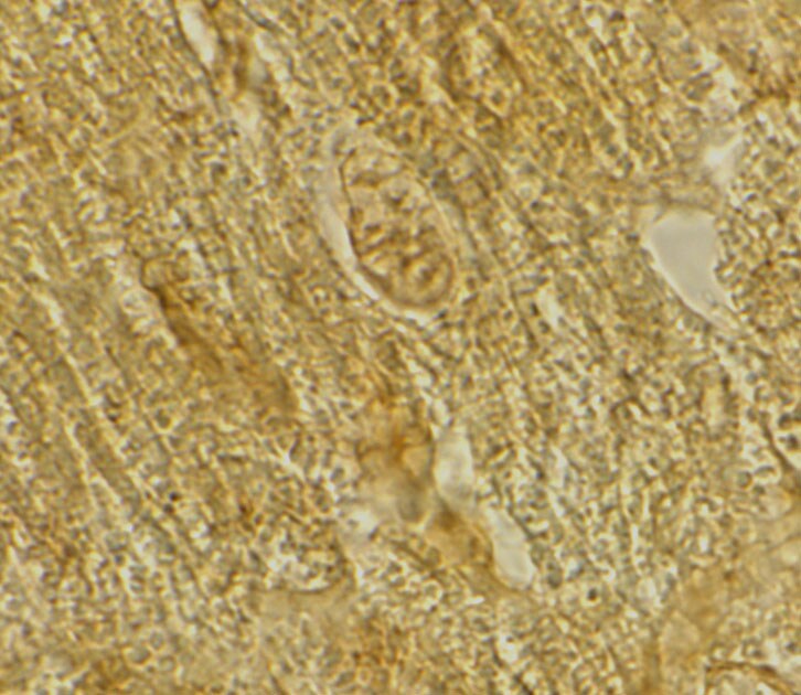 BACE-2 Antibody - BSA Free