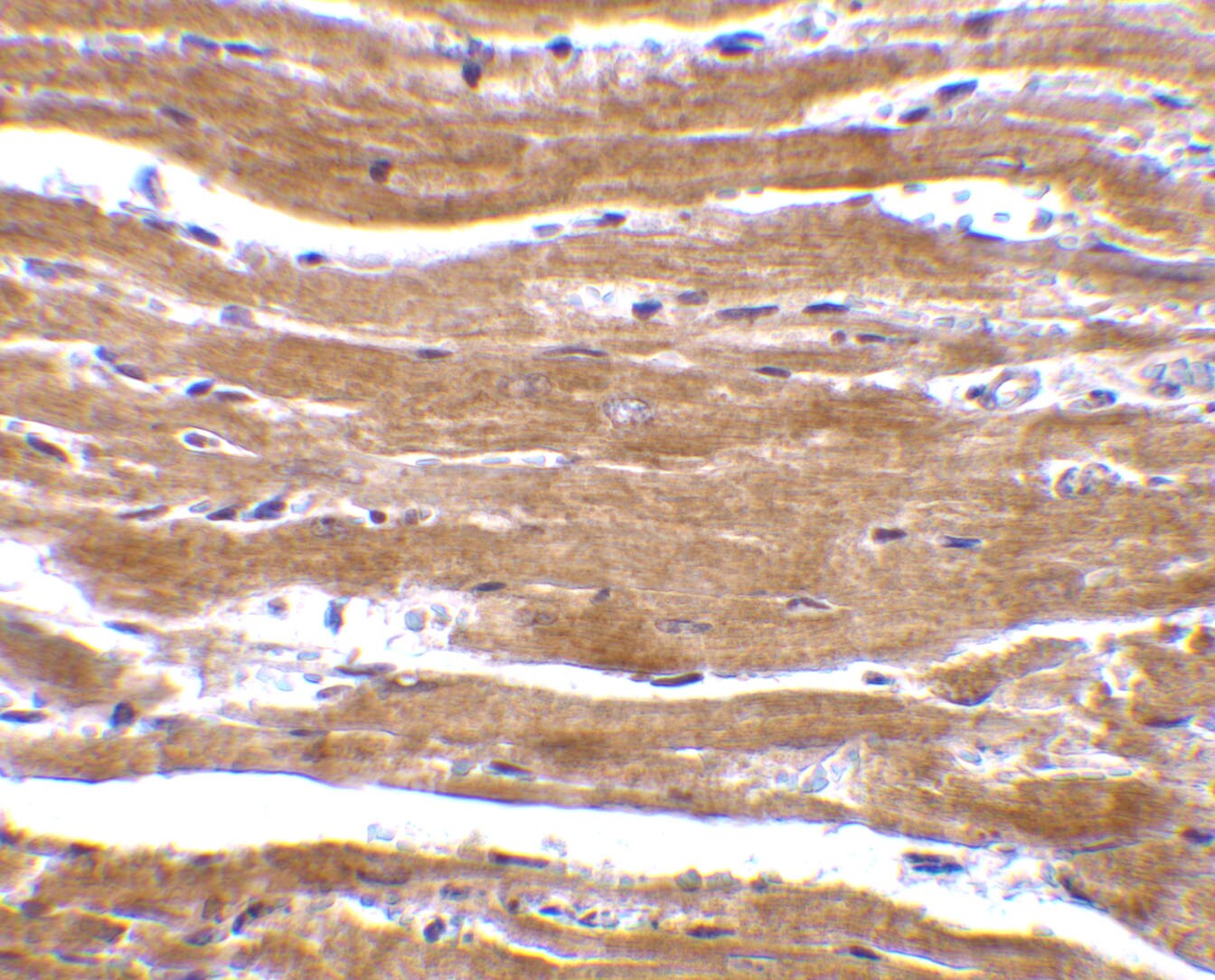 BACE-2 Antibody - BSA Free