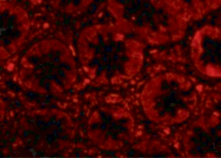 Endosialin/CD248/TEM1 Antibody - BSA Free