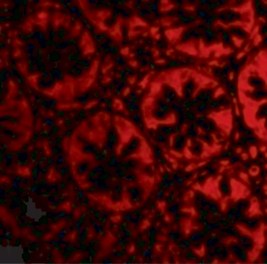 RASD2 Antibody - BSA Free