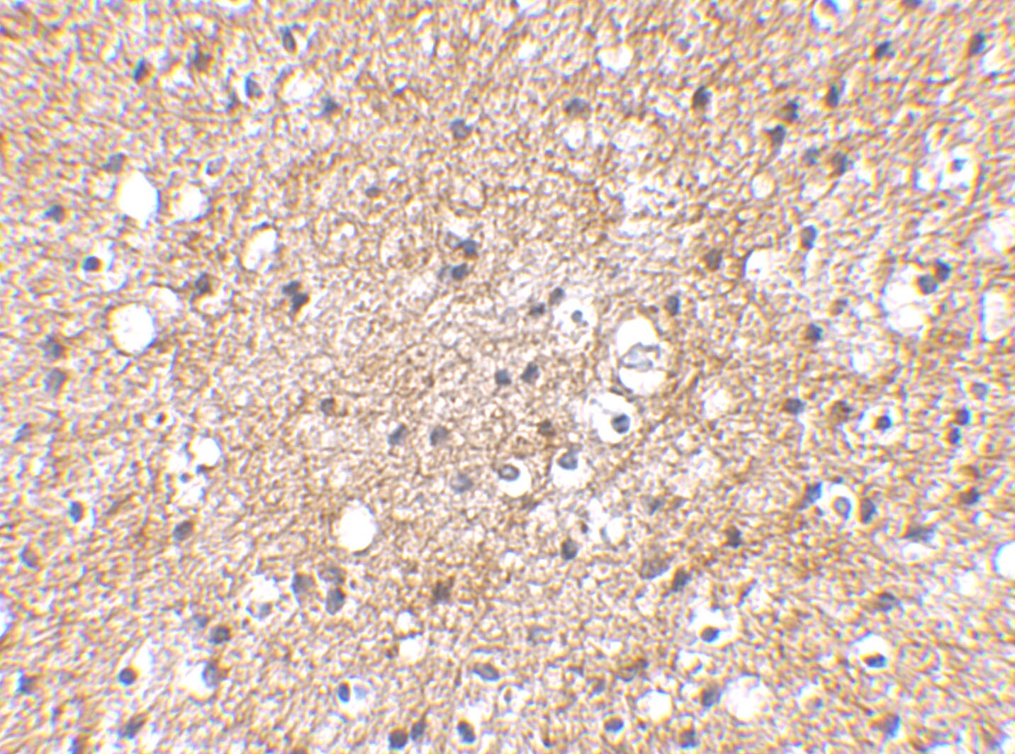 SP110 Antibody - BSA Free
