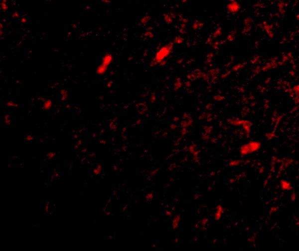 FBXL20 Antibody - BSA Free
