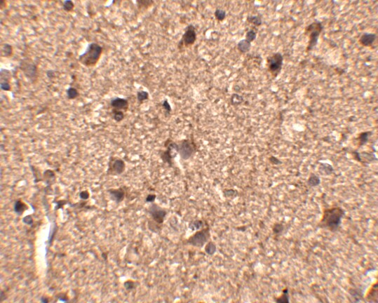 SLITRK1 Antibody - BSA Free