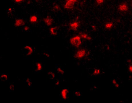 SLITRK1 Antibody - BSA Free