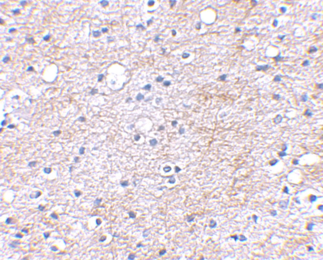 Lgi1 Antibody - BSA Free