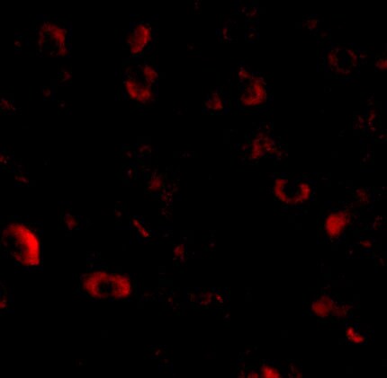 CADPS Antibody - BSA Free