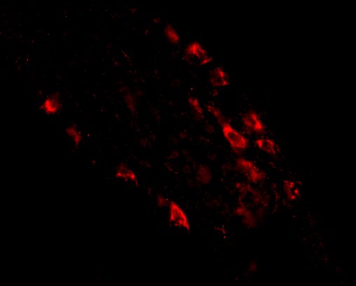 MEX3D Antibody - BSA Free