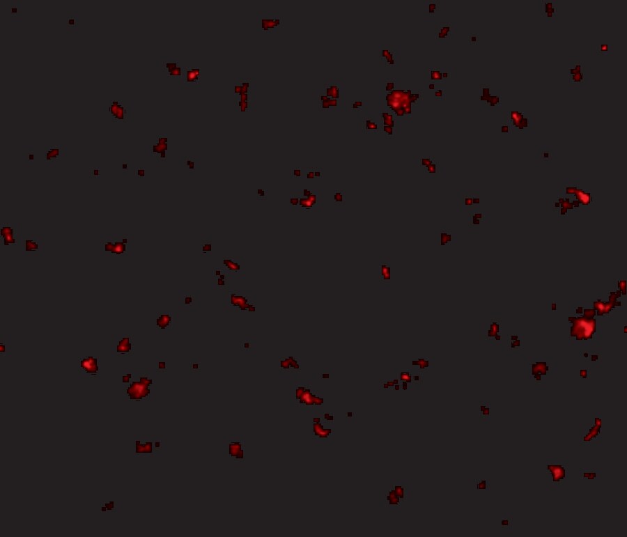 AAK1 Antibody - BSA Free