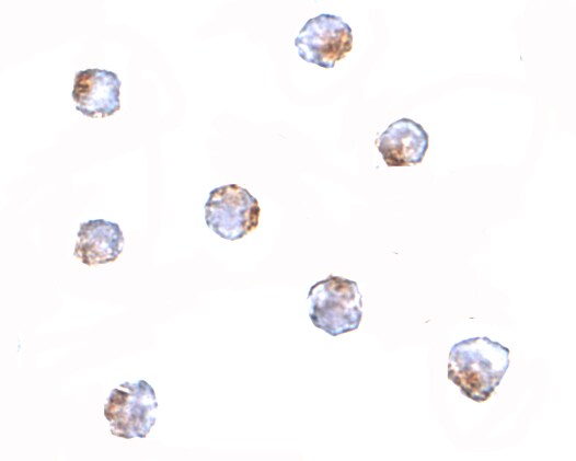 AAK1 Antibody - BSA Free