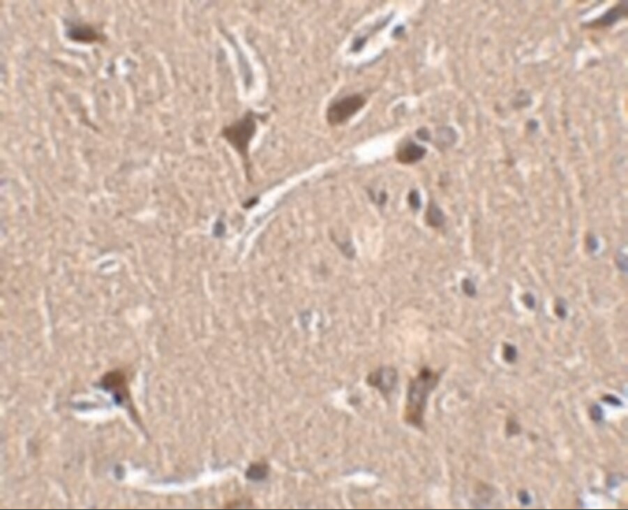 ZNF667 Antibody - BSA Free