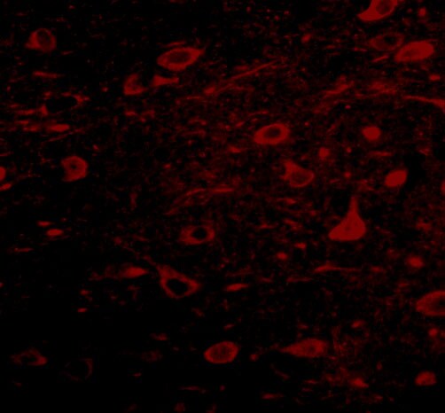 ZNF667 Antibody - BSA Free