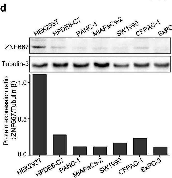 ZNF667 Antibody - BSA Free