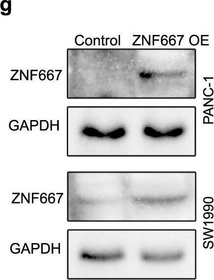 ZNF667 Antibody - BSA Free