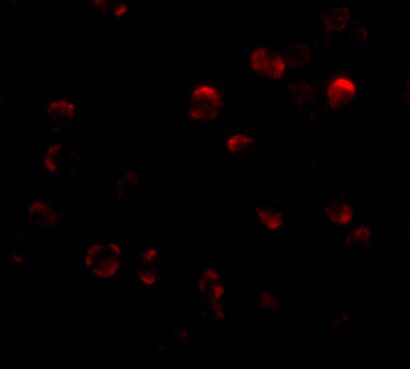 KLHL15 Antibody - BSA Free
