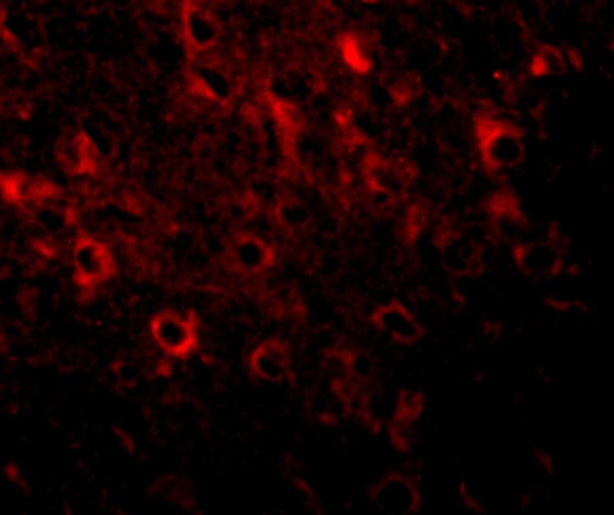 FAM120A Antibody - BSA Free