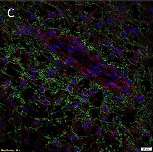 AGTR-2 Antibody - BSA Free