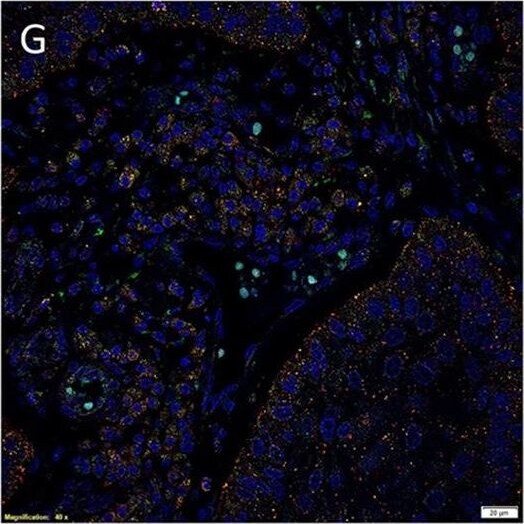 AGTR-2 Antibody - BSA Free