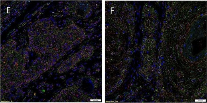 AGTR-2 Antibody - BSA Free