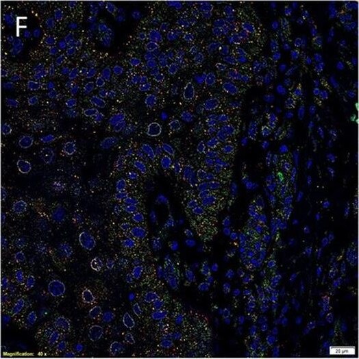 AGTR-2 Antibody - BSA Free
