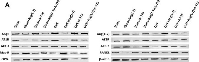 AGTR-2 Antibody - BSA Free