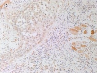 AGTR-2 Antibody - BSA Free