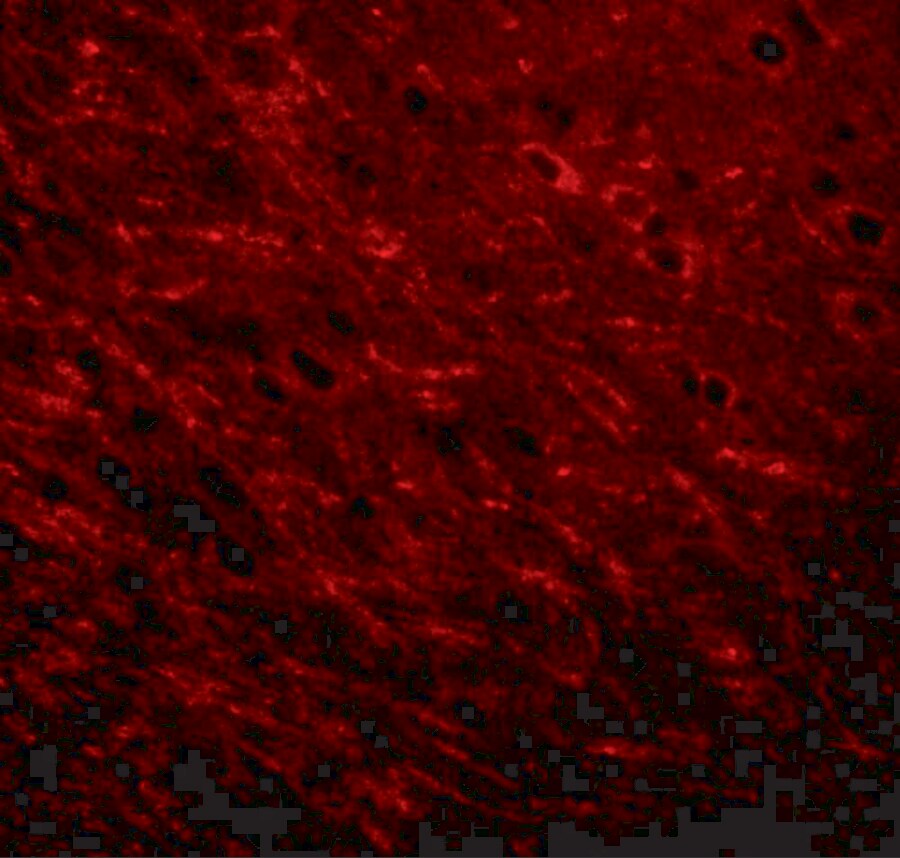 ProSAPiP1 Antibody - BSA Free