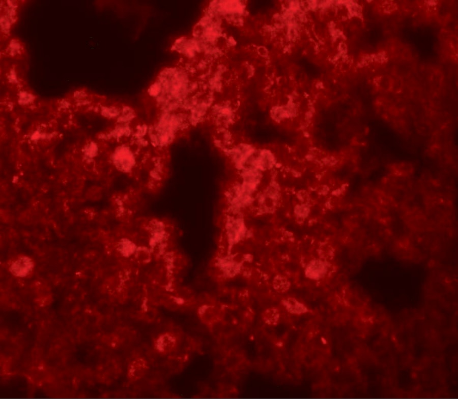 SRPX2 Antibody - BSA Free